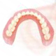 プロインパクト義歯